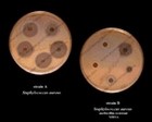 staphylococcus aureus susceptibility testing